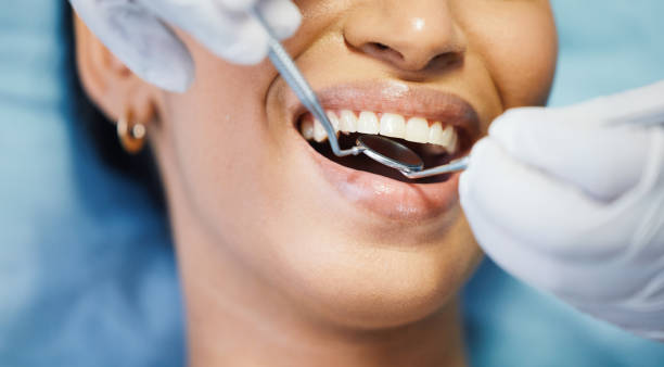 Best Emergency Tooth Extraction in Mineral Wells, TX